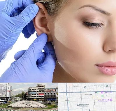 اتوپلاستی در مرکز تهران