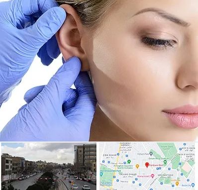 اتوپلاستی در بلوار فردوسی مشهد