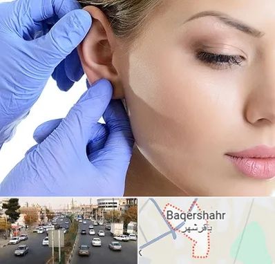 اتوپلاستی در باقرشهر