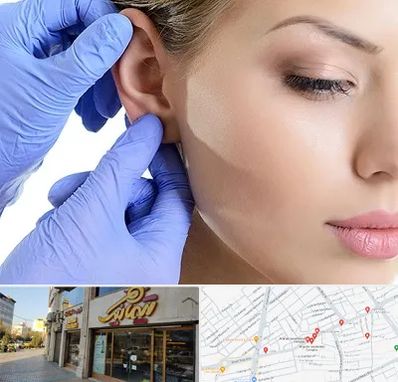 اتوپلاستی در عطاران قم