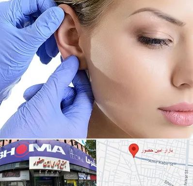 اتوپلاستی در امین حضور