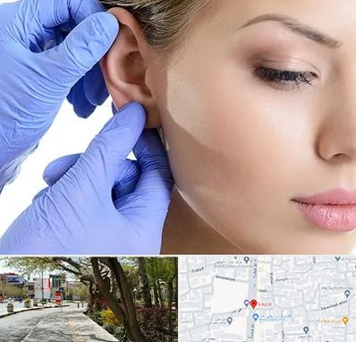 اتوپلاستی در خیابان توحید اصفهان