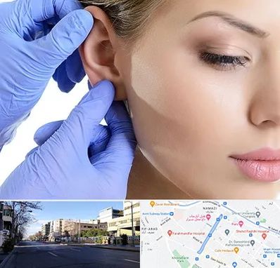 اتوپلاستی در خیابان ملاصدرا شیراز