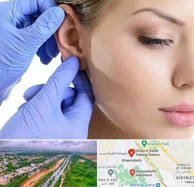 اتوپلاستی در قصرالدشت شیراز