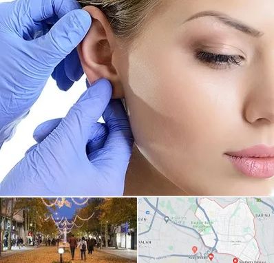 اتوپلاستی در ولیعصر ارومیه