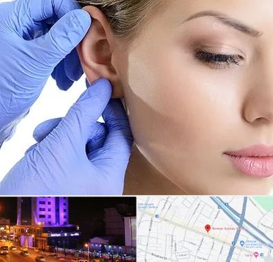 اتوپلاستی در آبرسان تبریز