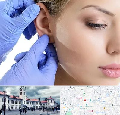 اتوپلاستی در میدان شهرداری رشت