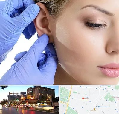 اتوپلاستی در بلوار سجاد مشهد