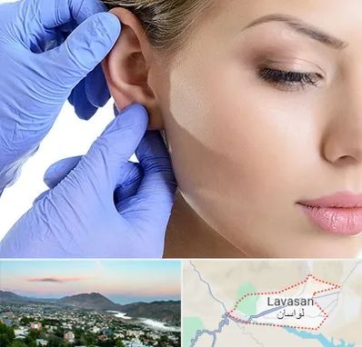 اتوپلاستی در لواسان