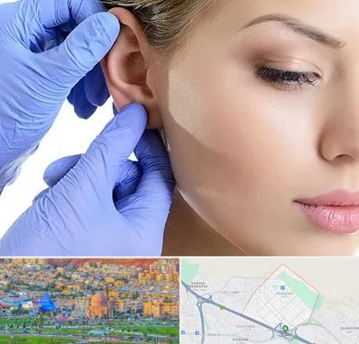 اتوپلاستی در رشدیه تبریز