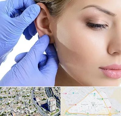 اتوپلاستی در قاسم آباد مشهد