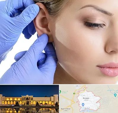 اتوپلاستی در برازجان