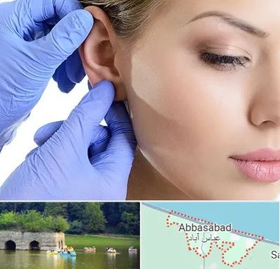 اتوپلاستی در عباس آباد