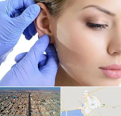 اتوپلاستی در بندر ماهشهر