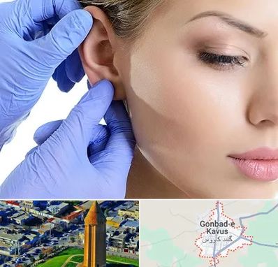 اتوپلاستی در گنبد کاووس
