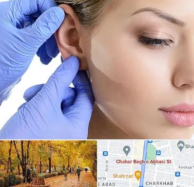 اتوپلاستی در چهارباغ اصفهان
