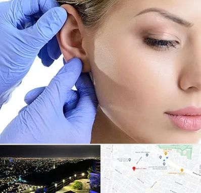 اتوپلاستی در هفت تیر مشهد