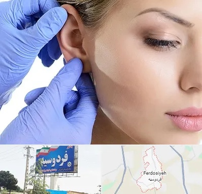 اتوپلاستی در فردوسیه شهریار