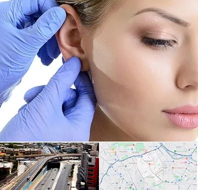 اتوپلاستی در ستارخان شیراز