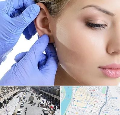 اتوپلاستی در نادری اهواز