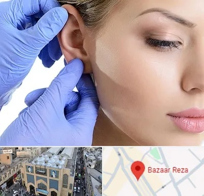 اتوپلاستی در بازار رضا مشهد