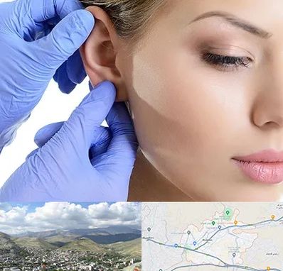 اتوپلاستی در رودهن