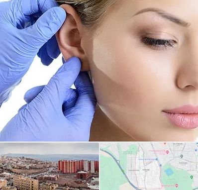 اتوپلاستی در سهند تبریز