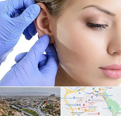 اتوپلاستی در معالی آباد شیراز