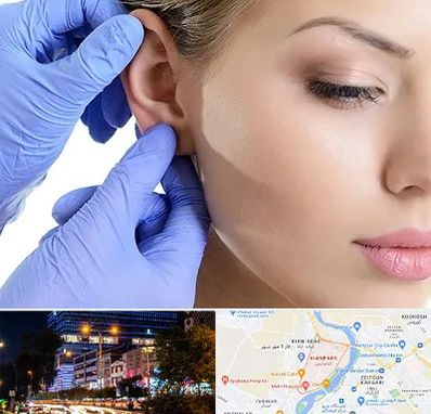 اتوپلاستی در کیانپارس اهواز