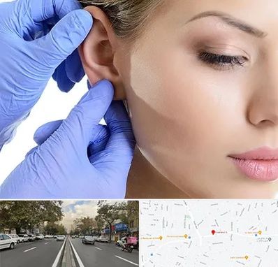 اتوپلاستی در دولت