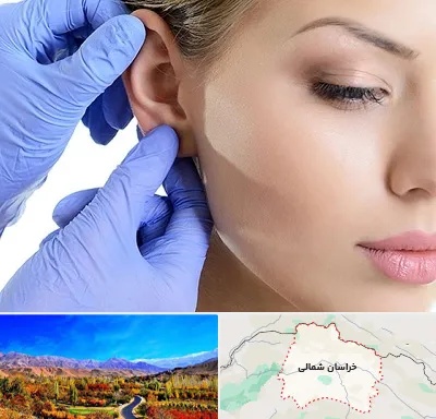 اتوپلاستی در خراسان شمالی