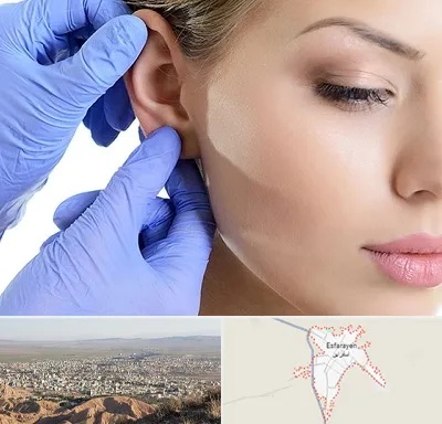 اتوپلاستی در اسفراین
