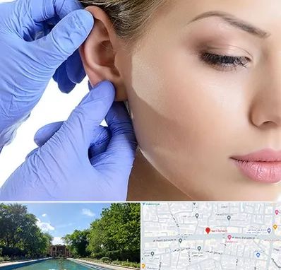 اتوپلاستی در هشت بهشت اصفهان