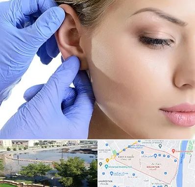 اتوپلاستی در گلستان اهواز