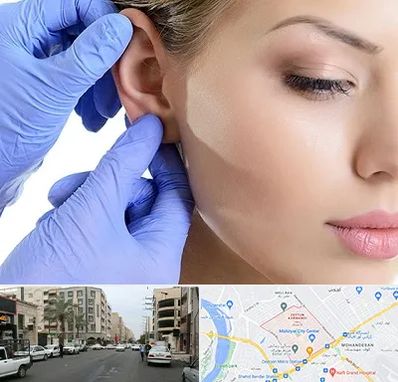 اتوپلاستی در زیتون کارمندی اهواز