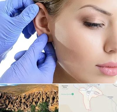 اتوپلاستی در اسکو