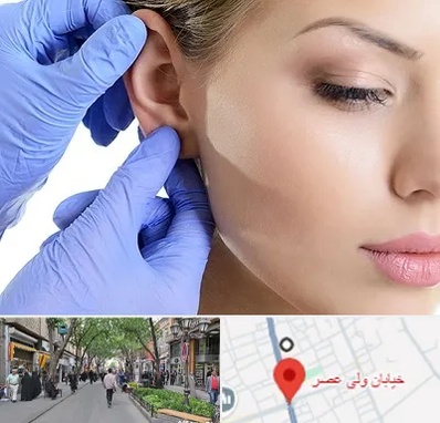 اتوپلاستی در ولیعصر شهریار