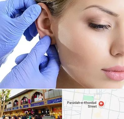 اتوپلاستی در 15 خرداد