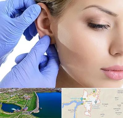 اتوپلاستی در مهاباد