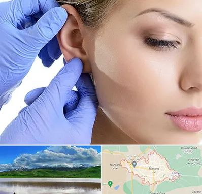 اتوپلاستی در مرند