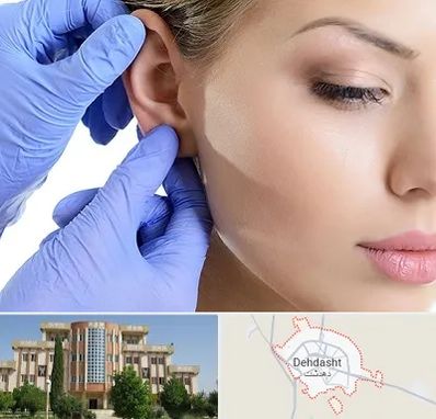 اتوپلاستی در دهدشت