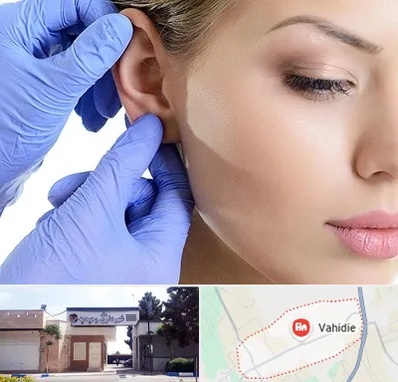 اتوپلاستی در وحیدیه شهریار