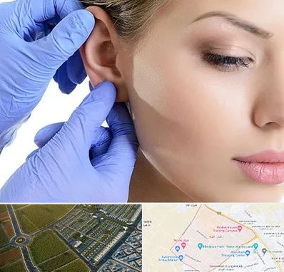 اتوپلاستی در الهیه مشهد