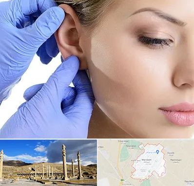 اتوپلاستی در مرودشت