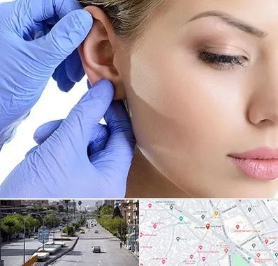 اتوپلاستی در خیابان زند شیراز