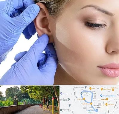 اتوپلاستی در بلوار گیلان رشت