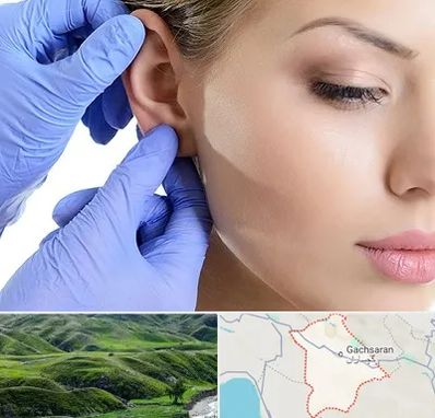اتوپلاستی در گچساران