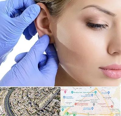 اتوپلاستی در شهرک غرب مشهد