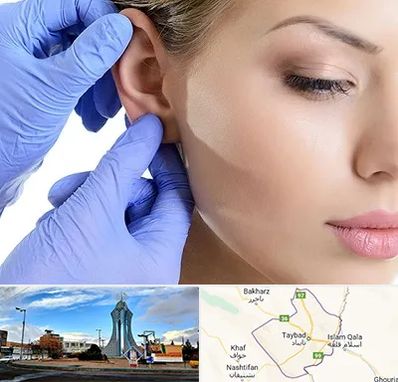 اتوپلاستی در تایباد