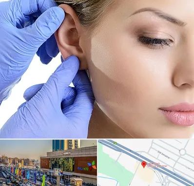 اتوپلاستی در لاله پارک تبریز